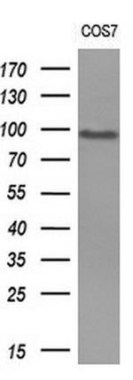 MALT1 Antibody in Western Blot (WB)