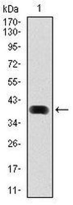 LC3B Antibody in Western Blot (WB)