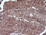 MAP2K1 Antibody in Immunohistochemistry (Paraffin) (IHC (P))