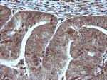 MAP2K1 Antibody in Immunohistochemistry (Paraffin) (IHC (P))