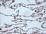 MAP2K1 Antibody in Immunohistochemistry (Paraffin) (IHC (P))