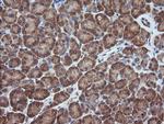 MAP2K1 Antibody in Immunohistochemistry (Paraffin) (IHC (P))