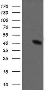 MAP2K1 Antibody in Western Blot (WB)