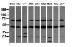 MAP2K1 Antibody in Western Blot (WB)