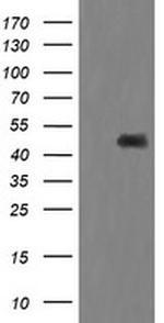 MAP2K1 Antibody in Western Blot (WB)