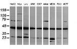 MAP2K1 Antibody in Western Blot (WB)