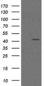 MAP2K1 Antibody in Western Blot (WB)