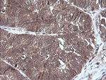 MAP2K3 Antibody in Immunohistochemistry (Paraffin) (IHC (P))