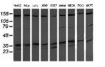 MAP2K3 Antibody in Western Blot (WB)