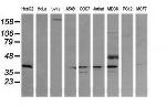 MAP2K3 Antibody in Western Blot (WB)