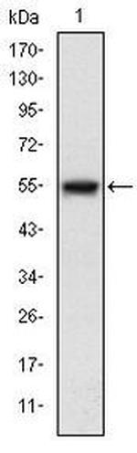 ASK1 Antibody in Western Blot (WB)