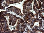 MAPK9 Antibody in Immunohistochemistry (Paraffin) (IHC (P))