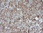 MAPK9 Antibody in Immunohistochemistry (Paraffin) (IHC (P))