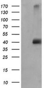 MAPK9 Antibody in Western Blot (WB)