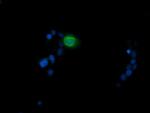 MDM4 Antibody in Immunocytochemistry (ICC/IF)