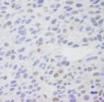 CRSP1/TRAP220 Antibody in Immunohistochemistry (IHC)