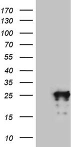 MED19 Antibody in Western Blot (WB)