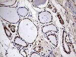 MEIS1 Antibody in Immunohistochemistry (Paraffin) (IHC (P))