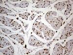 MEIS1 Antibody in Immunohistochemistry (Paraffin) (IHC (P))