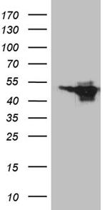 MEIS1 Antibody in Western Blot (WB)