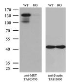 MET Antibody in Western Blot (WB)