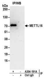 METTL16 Antibody in Immunoprecipitation (IP)