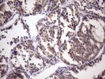 MGC12965 Antibody in Immunohistochemistry (Paraffin) (IHC (P))