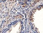 MICAL1 Antibody in Immunohistochemistry (Paraffin) (IHC (P))