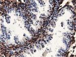 MICAL1 Antibody in Immunohistochemistry (Paraffin) (IHC (P))