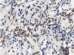 MICAL1 Antibody in Immunohistochemistry (Paraffin) (IHC (P))