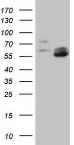 MMP3 Antibody in Western Blot (WB)