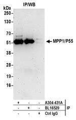 MPP1/P55 Antibody in Western Blot (WB)