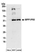 MPP1/P55 Antibody in Western Blot (WB)