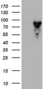 MPP5 Antibody in Western Blot (WB)