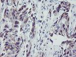 MRPS27 Antibody in Immunohistochemistry (Paraffin) (IHC (P))