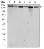 MSH6 Antibody in Western Blot (WB)