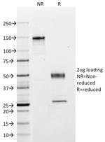 Cytokeratin, Multi (Epithelial Marker) Antibody in SDS-PAGE (SDS-PAGE)