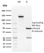 HPV16 E2 (Human Papilloma Virus 16) Antibody in SDS-PAGE (SDS-PAGE)