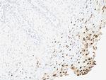 HPV-16 (Human Papilloma Virus 16) Antibody in Immunohistochemistry (Paraffin) (IHC (P))