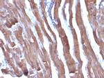 Actin, Muscle Specific (Muscle Cell Marker) Antibody in Immunohistochemistry (Paraffin) (IHC (P))