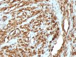 Actin, Muscle Specific (Muscle Cell Marker) Antibody in Immunohistochemistry (Paraffin) (IHC (P))