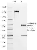 HPV-16 (Human Papilloma Virus 16) Antibody in SDS-PAGE (SDS-PAGE)