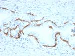 Cytokeratin 5/6 (Basal, Myoepithelial and Mesothelial Cell Marker) Antibody in Immunohistochemistry (Paraffin) (IHC (P))