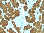 Cytokeratin 5/6 (Basal, Myoepithelial and Mesothelial Cell Marker) Antibody in Immunohistochemistry (Paraffin) (IHC (P))