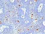 HPV-16 (Human Papilloma Virus 16) Antibody in Immunohistochemistry (Paraffin) (IHC (P))