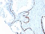 Cytokeratin 5/6 (Basal, Myoepithelial and Mesothelial Cell Marker) Antibody in Immunohistochemistry (Paraffin) (IHC (P))