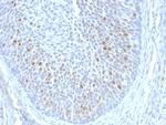 HPV16 E1/E4 (Human Papilloma Virus 16) Antibody in Immunohistochemistry (Paraffin) (IHC (P))