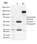 HPV16 E1/E4 (Human Papilloma Virus 16) Antibody in SDS-PAGE (SDS-PAGE)