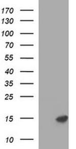 MSMB Antibody in Western Blot (WB)