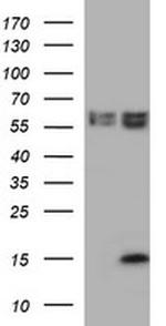 MSMB Antibody in Western Blot (WB)